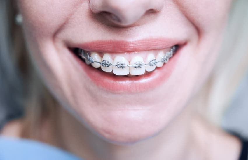 Dental Bridges in Boston, MA - Center Plaza Dental